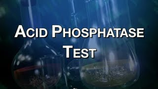 Acid Phosphatase Test [upl. by Amata]