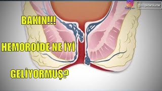 HEMOROÄ°DÄ°N TEDAVÄ°SÄ° MUTFAÄINIZDA  HEMOROÄ°D NASIL GEÃ‡ER EVDE [upl. by Tsiuqram29]