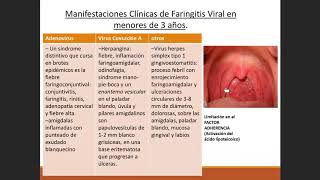 Pediatría  Faringoamigdalitis Aguda y Laringotraqueitis 11 [upl. by Euqinemod]