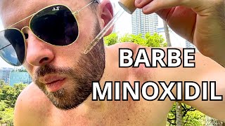 Minoxidil Barbe  Mythe ou Arnaque  Découvrez la Réalité [upl. by Victoir]