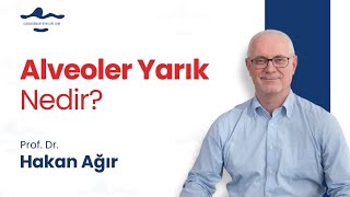 Alveoler yarık nedir  Prof Dr Hakan Ağır [upl. by Killie411]