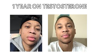 1 Year On Testosterone Update [upl. by Sussman447]