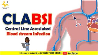 CLABSI  Central line related bloodstream infection  CLABSI Bundle  Types of CVCs [upl. by Aeirdna]