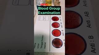 blood Group test  blood Group examination  blood Group microbiology  lablife shorts short [upl. by Kram]