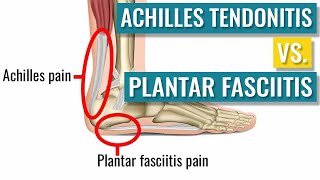 Achilles Tendonitis vs Plantar Fasciitis [upl. by Enimsay]