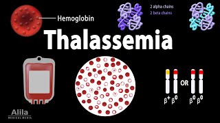 Thalassemia Alpha amp BetaThalassemias Genetics Pathophysiology Diagnosis amp Treatment Animation [upl. by Noel46]