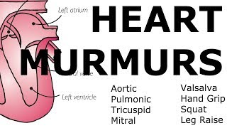 Heart Murmurs  Locations Maneuvers Buzzwords [upl. by Sarilda118]