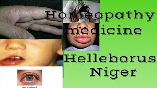 Helleborus Niger Homeopathy medicine in hindi by Premwati Yadav [upl. by Assirem516]