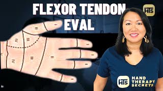 Flexor Tendon Injury amp Evaluation  Whats The FIRST Thing You Should Do [upl. by Acirderf]