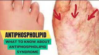 What to Know About Antiphospholipid Syndrome [upl. by Eleonora533]