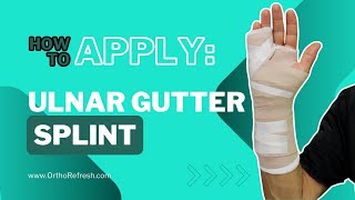 How To Apply an Ulnar Gutter Splint for a broken hand  Boxers Fracture [upl. by Onibla]