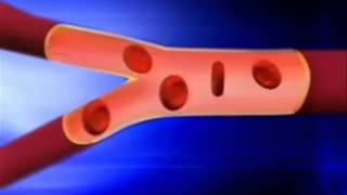 What is Sickle Cell Disease [upl. by Nauqal]