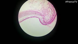 Histología Respiratorio  Tráquea Bronquio y Pulmón [upl. by Levin357]