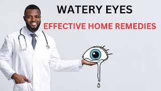 What Causes Watery Eyes  Effective Home Remedies For Watery Eyes [upl. by Riess]