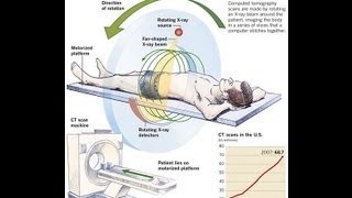 How CT Scan Machine Works [upl. by Alyt]