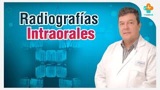 Radiografías Intraorales  Tu Salud Guía [upl. by Charin845]