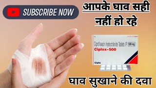 घाव सुखाने की दवाCiprofloxacin 500mg use ciprofloxacin hydrochloride helthptipsciplox [upl. by Scharf]