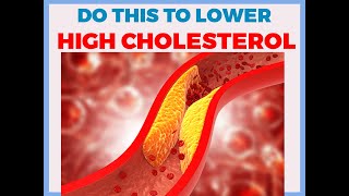 7 dietary tips including foods to lower your cholesterol cholesterol [upl. by Asilam]