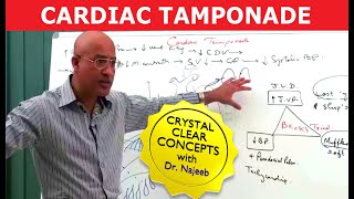 Cardiac Tamponade  Causes Symptoms and Treatment🫀 [upl. by Kwan500]