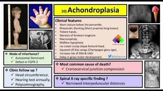 Achondroplasia [upl. by Heidi]