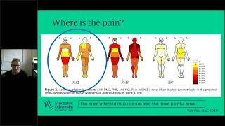 AsktheExpert Myotonic Dystrophy Type 2 amp Pain Management [upl. by Birdie]