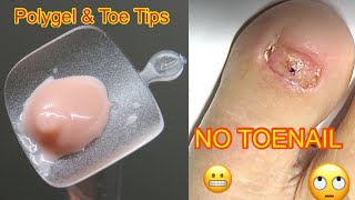 Polygel amp Toe Tips  Get a Toenail Easy [upl. by Amethist]