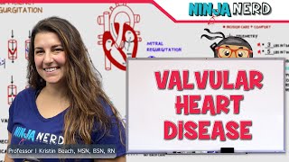 Valvular Heart Disease amp Mechanical Heart Valves [upl. by Nomis]