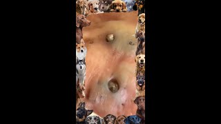 Blackhead Removal  18  Blackhead extraction  blackheads [upl. by Nelleus]