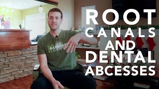 What you need to know about Root Canals and Dental Abscesses [upl. by Sinned488]