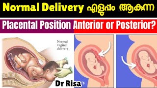 പ്രസവം എളുപ്പമാകുന്ന Placental Position  Anterior amp Posterior Placenta [upl. by Nannerb]