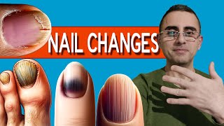 Nails as Health Indicators Top 13 Nail Changes [upl. by Eninnaej278]