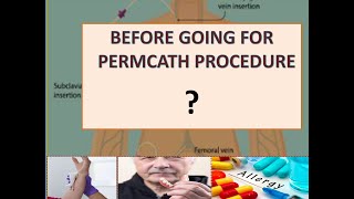 PERM CATH INSERTION PROCEDURE catheter hemodialisis dialysis [upl. by Kentiggerma]