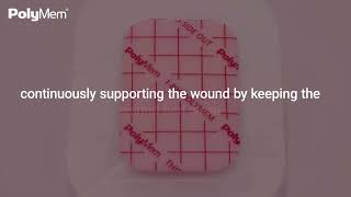 Wound Healing Journey with PolyMem Dressings  Part 2 Proliferative Phase [upl. by Virgina297]