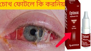 চোখ ফোটা বা চোখে ময়লা হলে ব্যবহার করুন quot Optimox Eye drop quot [upl. by Inaliak965]