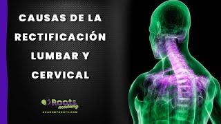 ¿ Qué produce la RECTIFICACIÓN LUMBAR Y CERVICAL ¡DESCÚBRELO AQUÍ [upl. by Enaols]