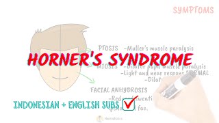 Horners syndrome pathophysiology  Neuroaholics [upl. by Ezitram]