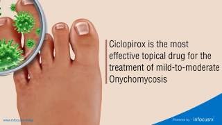 Ciclopirox is the most effective topical drug for the treatment of mildtomoderate Onychomycosis [upl. by Ainirtak222]