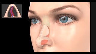 Sinus Rinse Animation [upl. by Fortin]