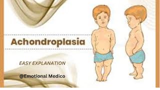 Achondroplasia  Bone pathology  emotionalmedico [upl. by Bisset]