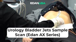 Urology Bladder Jets Ultrasound Demo Scan EdanAcclarix AX Series [upl. by Anitteb]