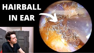 Painful Hairball Stuck In Ear Canal [upl. by Arais491]