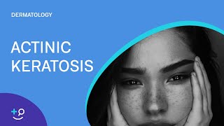 Actinic Keratosis Dermatology [upl. by Meneau]