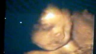 my baby 6 months 3D ultrasound [upl. by Ettenrahs603]