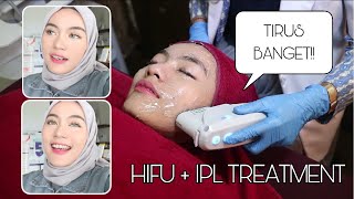 TREATMENT HIFU  IPL WORTH IT  ENHAKA [upl. by Eenej]