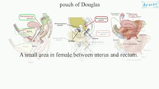 Anatomy and Clinical anatomy of Pouch of Douglas Rectouterine pouch Rectovesical pouch [upl. by Mathre]