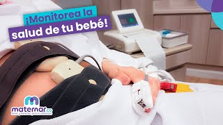 Monitoreo fetal ¿Qué es y para qué sirve  Maternarco [upl. by Irafat394]