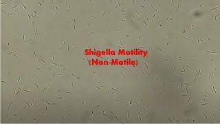 Shigella sonnei Motility [upl. by Acinoj]