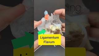 Ligamentum Flavum Modelling  Dynamic Disc Designs [upl. by Olathe]