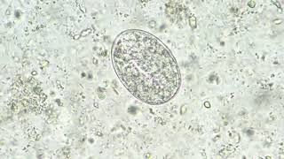 Strongyloides stercoralis egg [upl. by Alick]