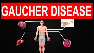 Gaucher Disease [upl. by Cadmar]